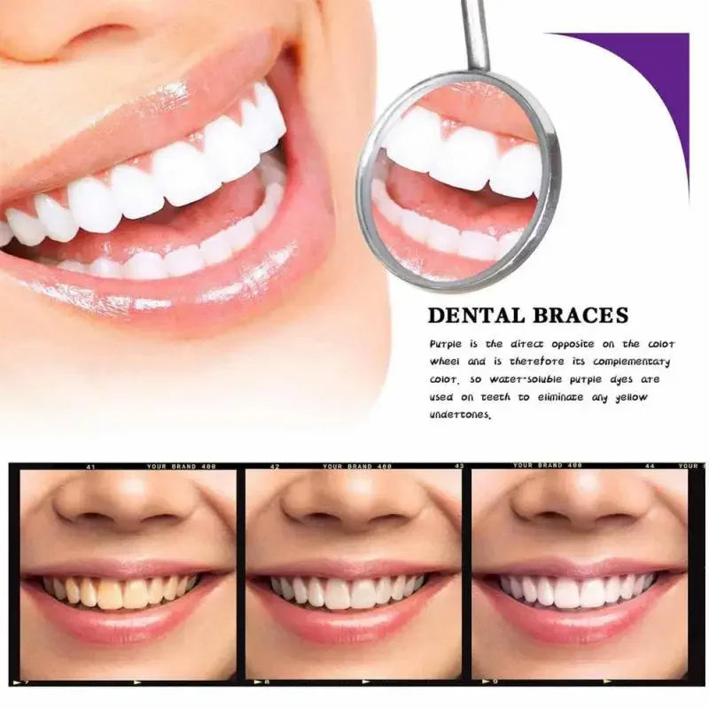 Sonrisa Radiante al Instante: V34 Blanqueador Dental Pasta de Dientes Morada